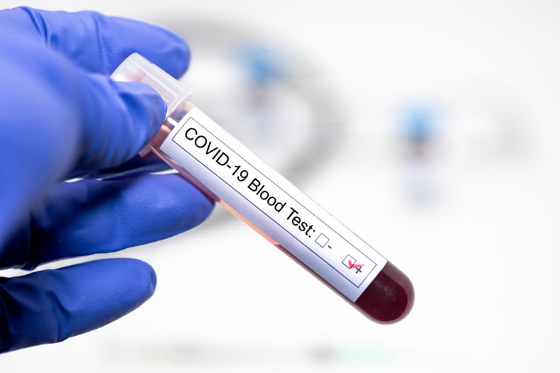 PCR test