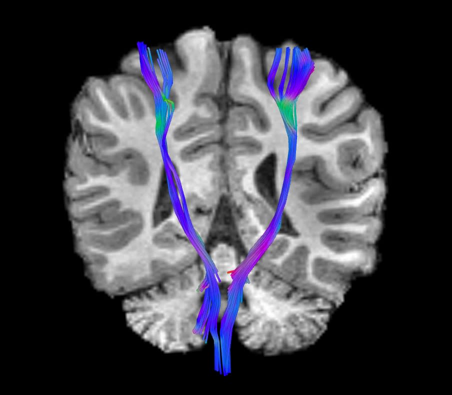 Each camper gets 2 MRIs during the camp!