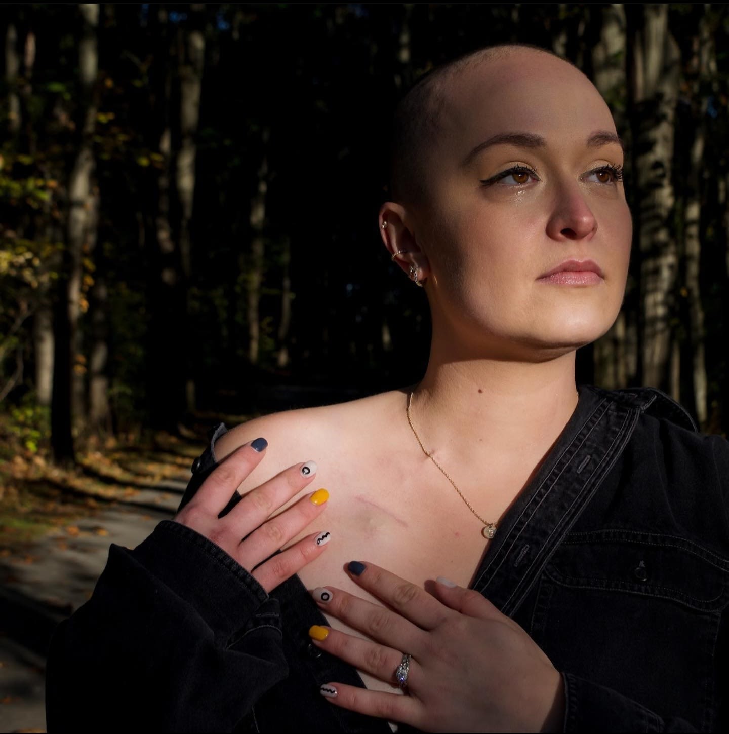 A bald woman standing before a forest of tall trees. One shoulder is exposed and her hands rest against it