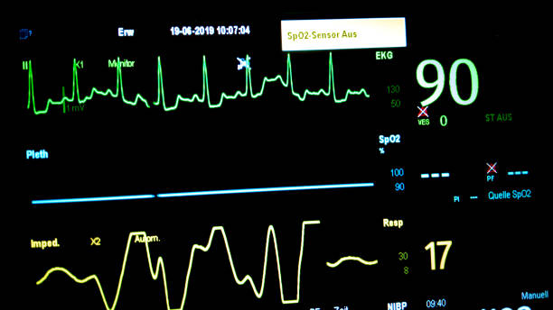 3,183 Cardiac Arrhythmia Stock Photos, Pictures & Royalty-Free Images -  iStock