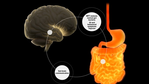 Microbiota Transplant Therapy-Children with Autism Image