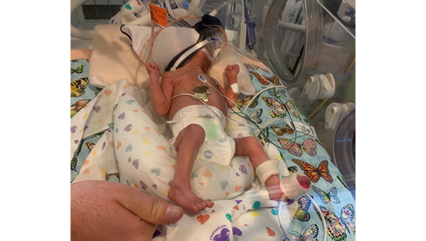 Newborn premature baby in the NICU