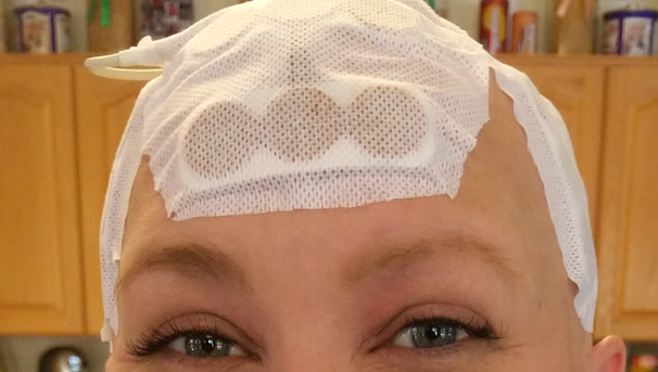 Emily looking at the camera post-surgery wearing a blue and white scarf on her head.