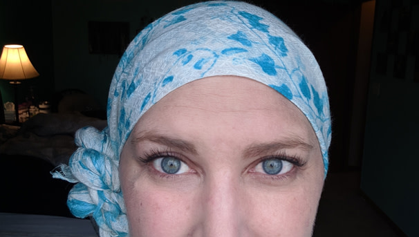 Emily post surgery wearing a device that helps fight the cancer while protecting her brain.