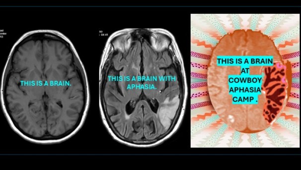 This is a brain at Cowboy Aphasia Camp.