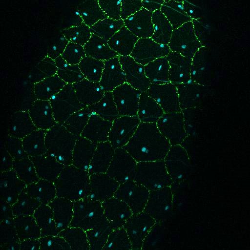 A microscopic view of mosquito tract