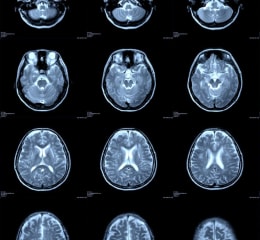 Private Full Body MRI Scans