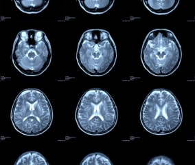 Private Full Body MRI Scans