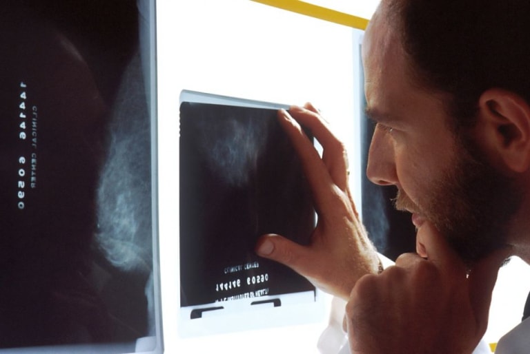 doctor looking closely at a scan