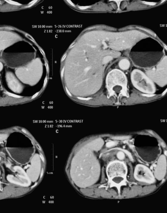 Book a private CT scan near you