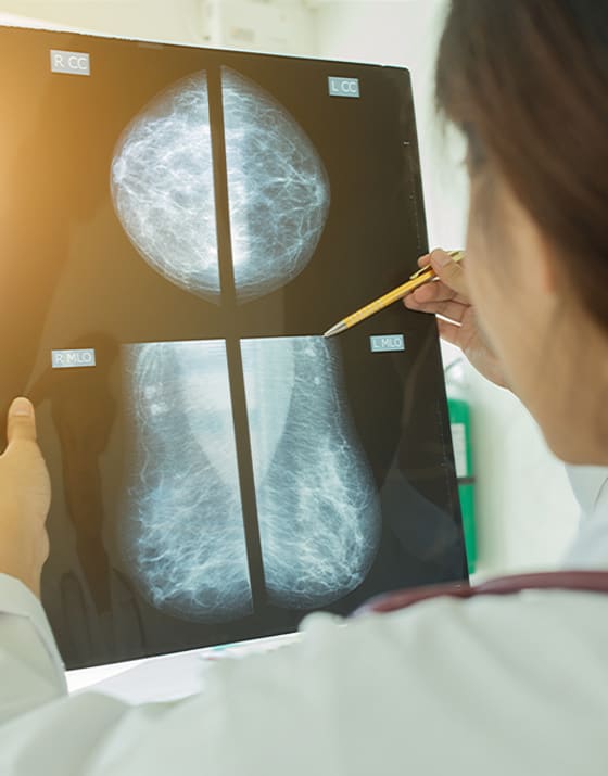 Book a private Mammogram scan near you