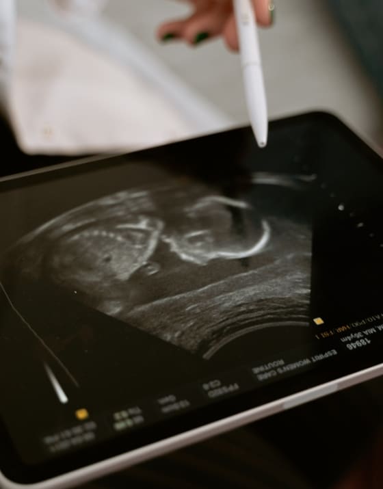 Book a private Pregnancy Ultrasound scan near you
