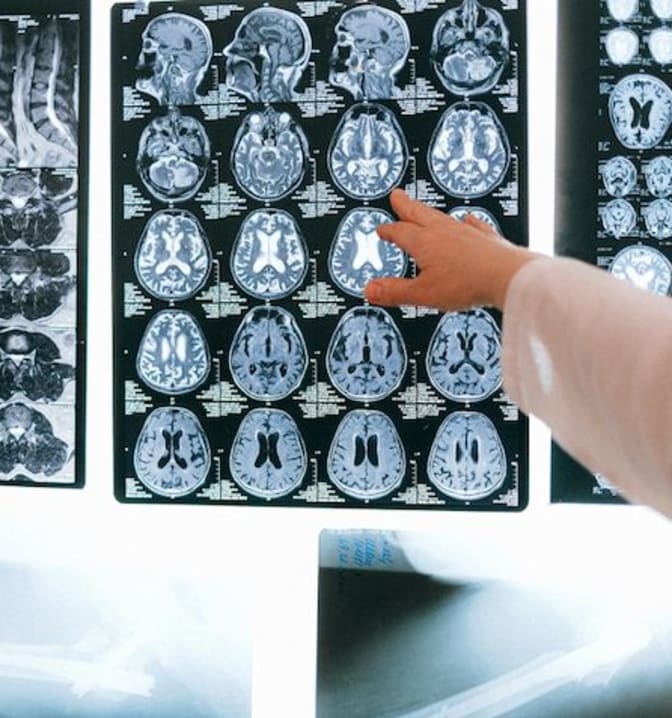 MRI scanner