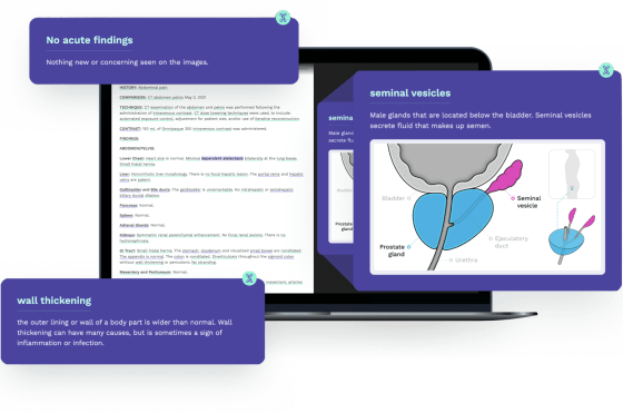 Imaging reports powered by Scanslated