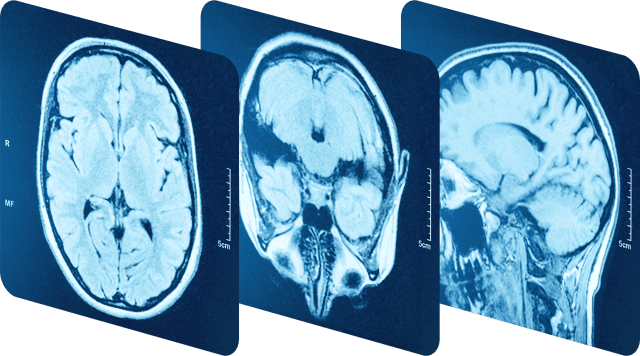 Image slices of a brain mri scan
