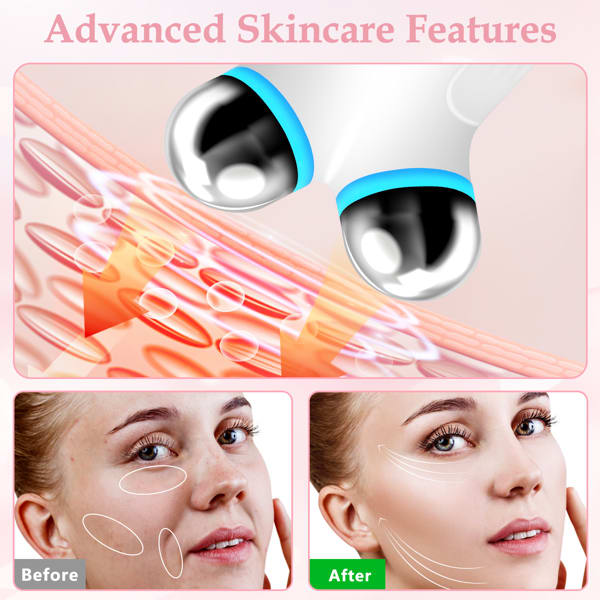 Facial Beauty Tools And EMS Beauty Equipment view 5
