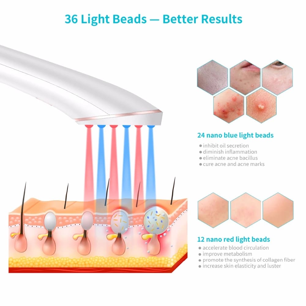 Acne Light Therapy Xpreen Wireless Rechargeable Light Acne Treatment Device Acne Clearing Eraser with Blue Light and Red Light view 9