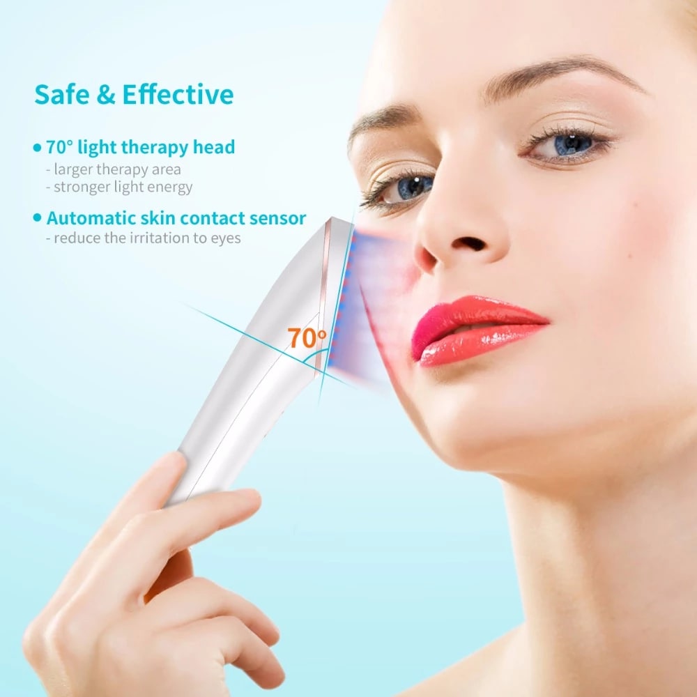 Acne Light Therapy Xpreen Wireless Rechargeable Light Acne Treatment Device Acne Clearing Eraser with Blue Light and Red Light view 10