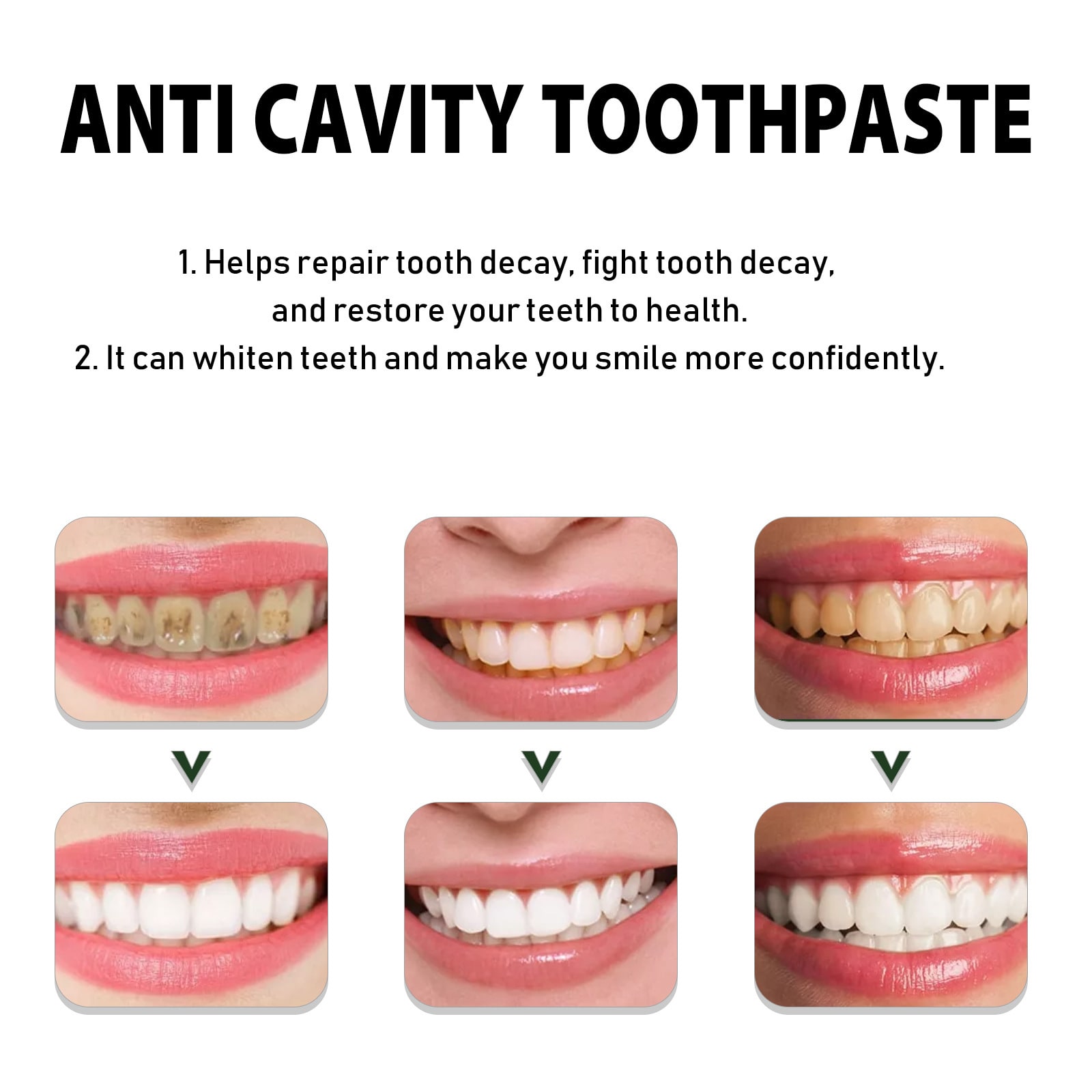 Deep Cleaning Tartar Stain Brightening Toothpaste view 6