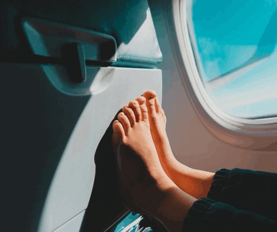 flying with varicose veins