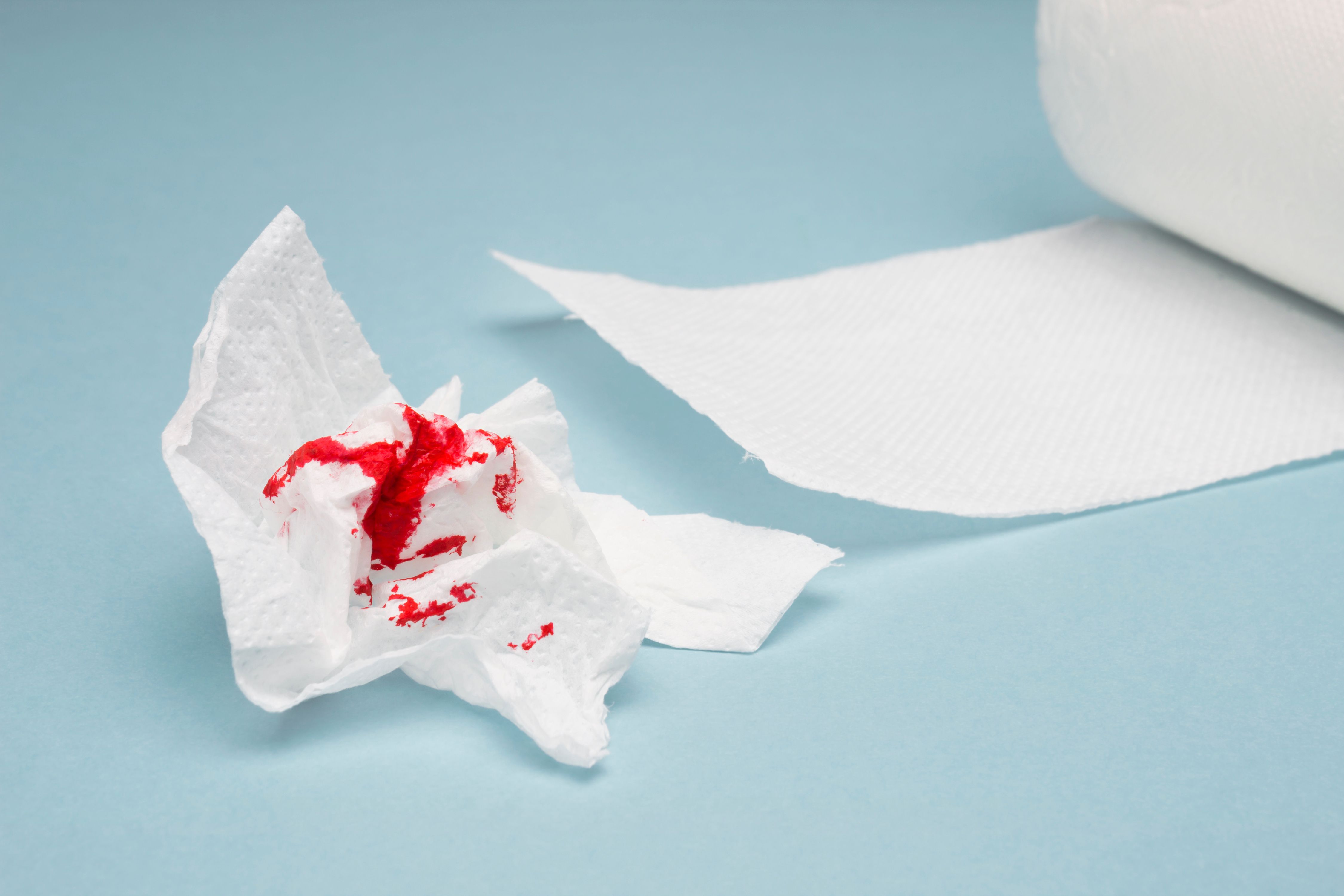bleeding hemorrhoids