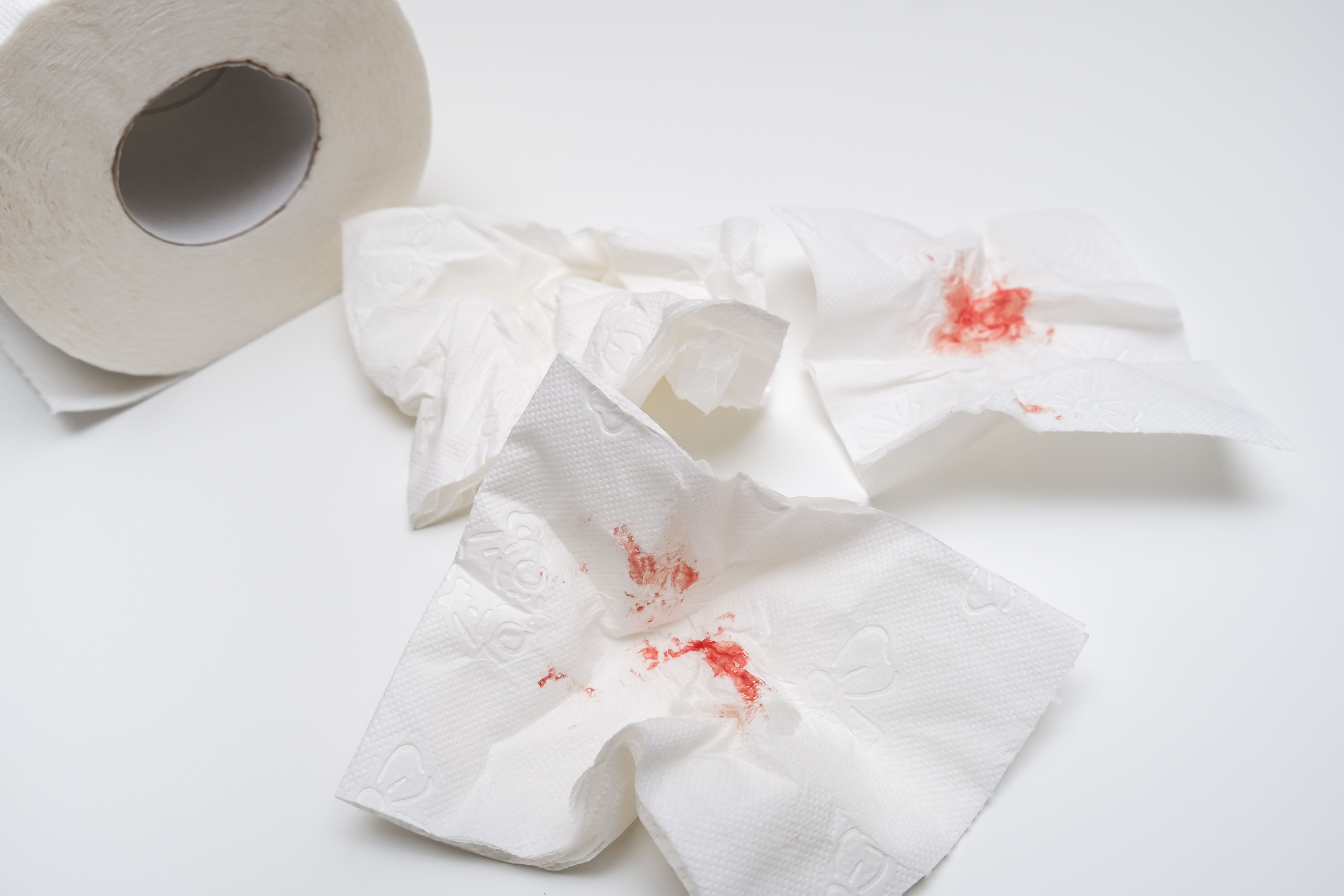 hemorrhoid bleeding and discharge
