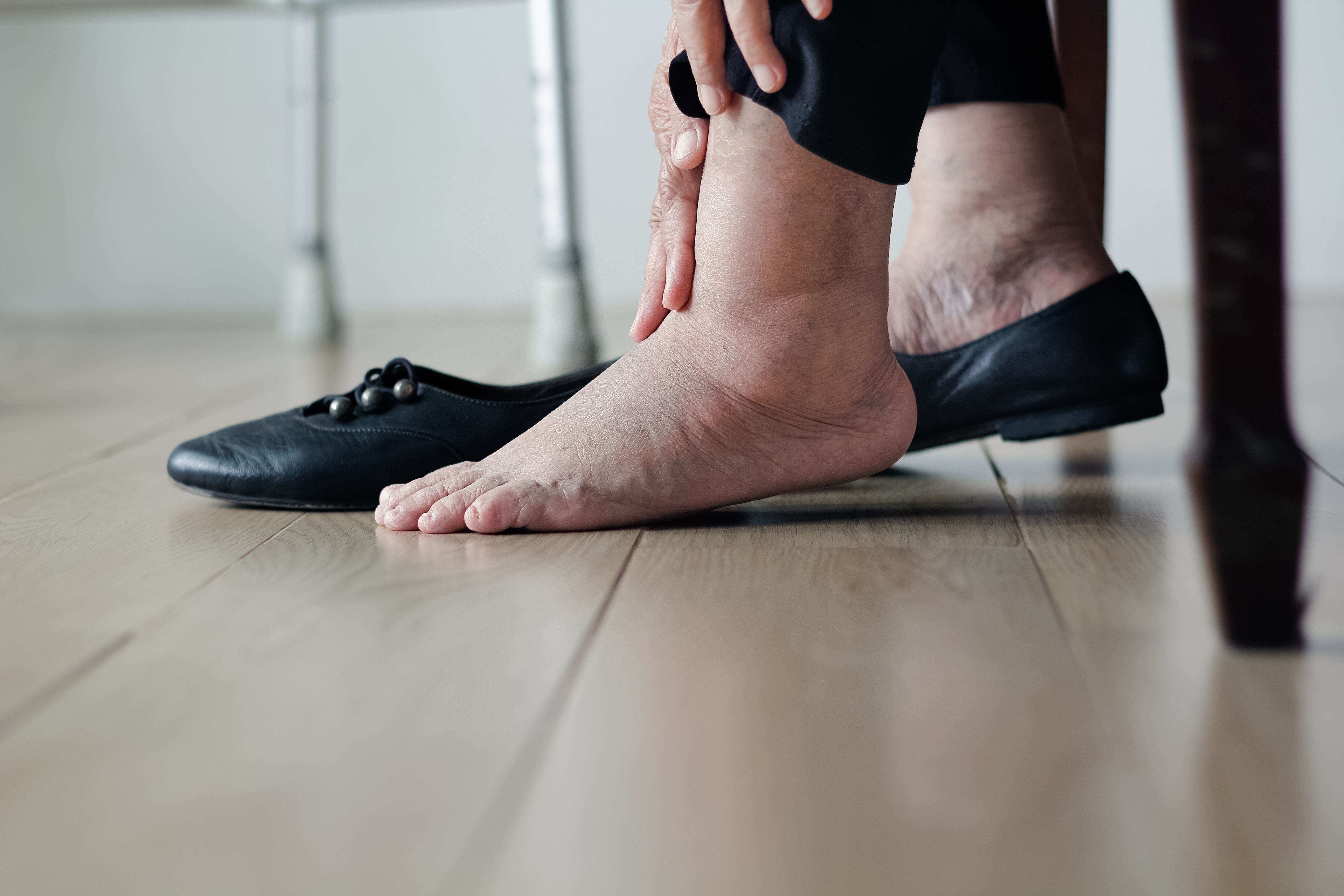reduce leg swelling