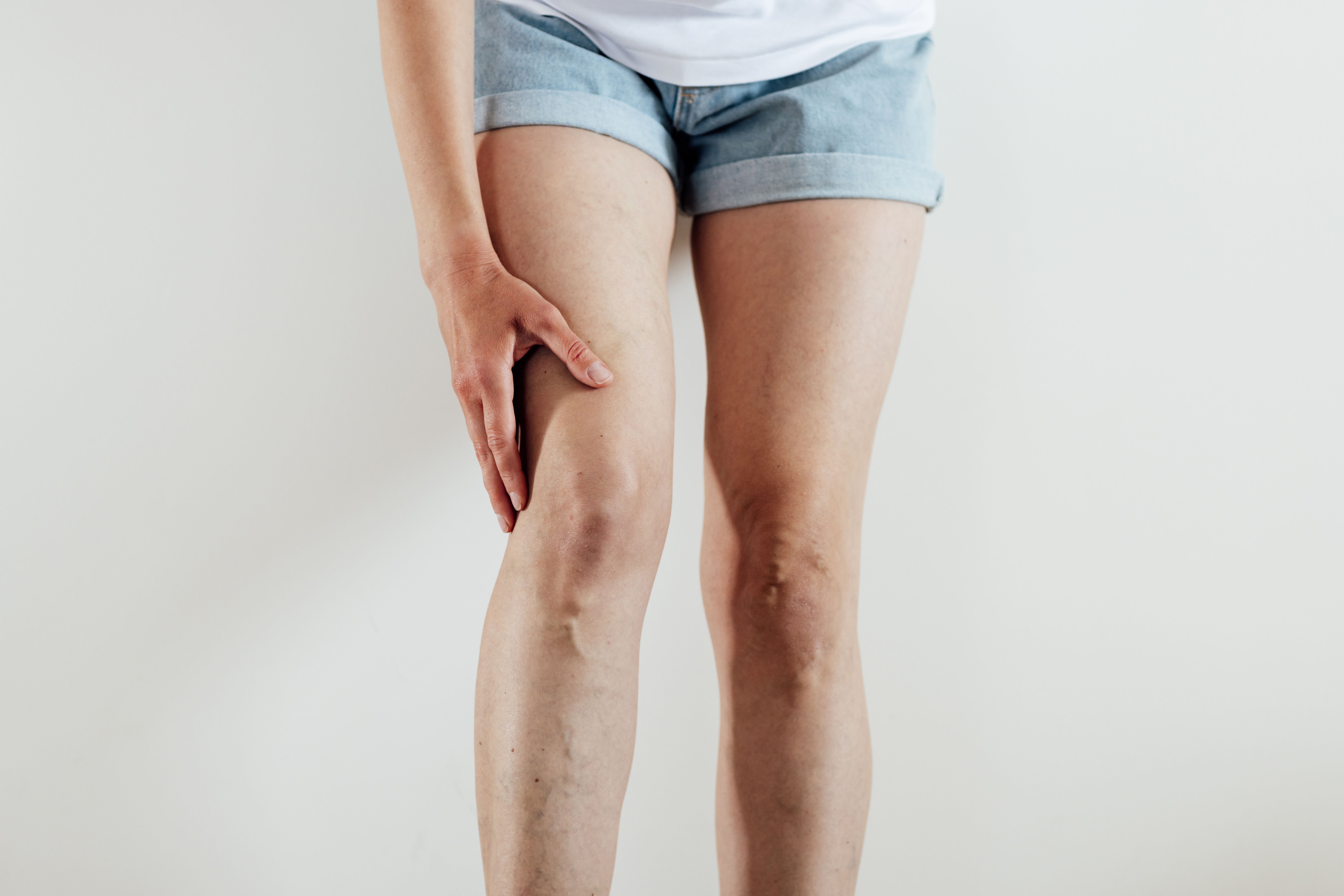 painful legs with varicose veins