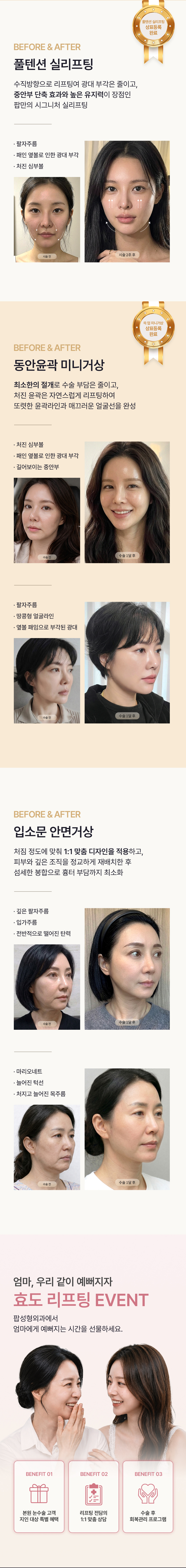 팝성형외과 리프팅 안내