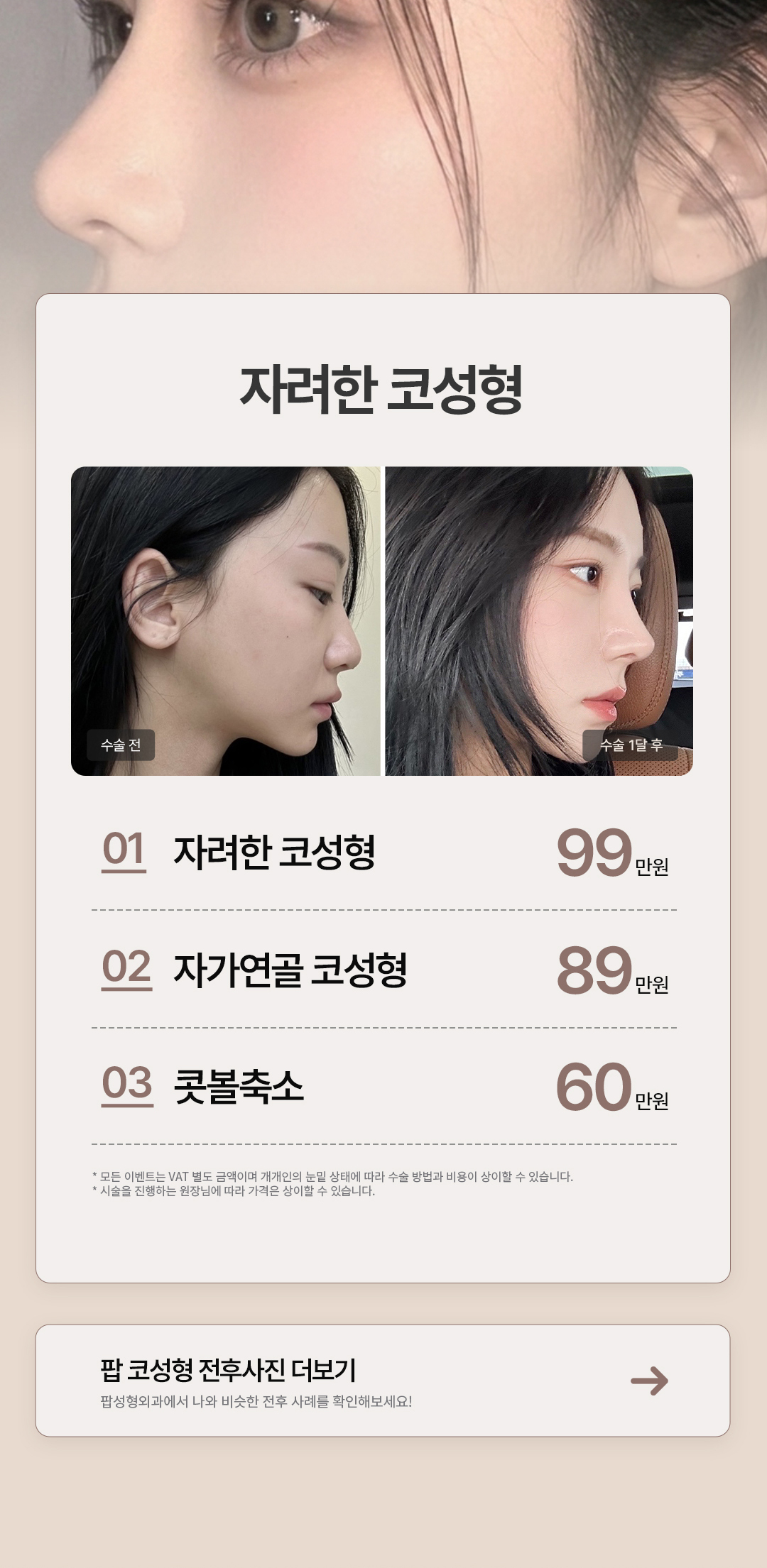팝 코성형 프로모션