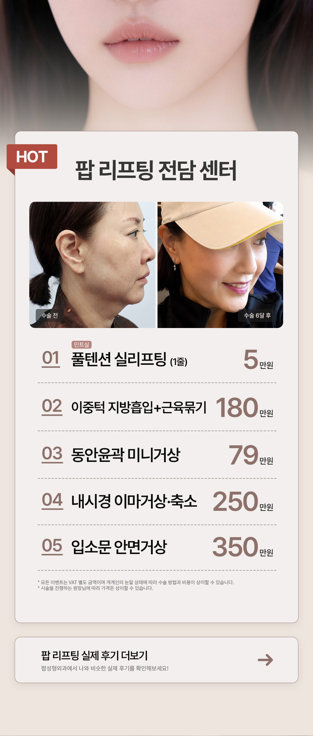 팝 리프팅 전담 센터