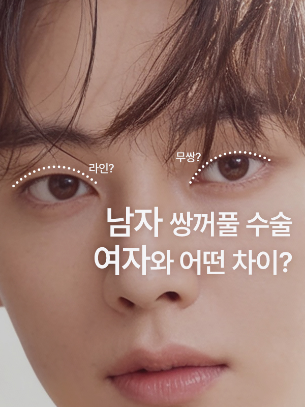 남자 쌍꺼풀 수술 여자와 디자인 차이