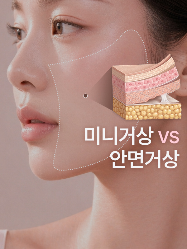 얼굴이 조금 처졌는데 꼭 안면거상을 해야 하나요 미니거상