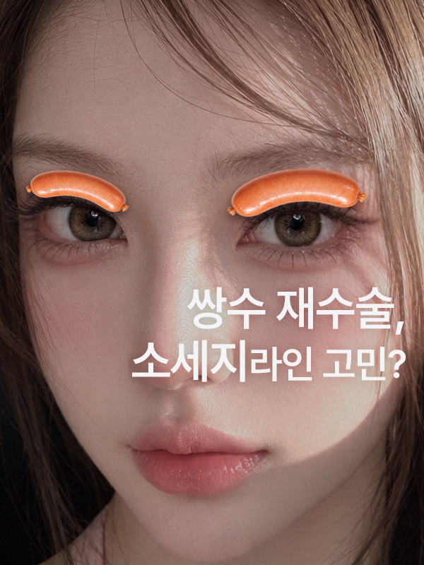 쌍수재수술 소세지눈 어떻게 해야 할까 대표 이미지