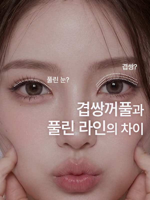 겹쌍꺼풀과 쌍꺼풀 풀림 차이를 설명하는 대표 이미지
