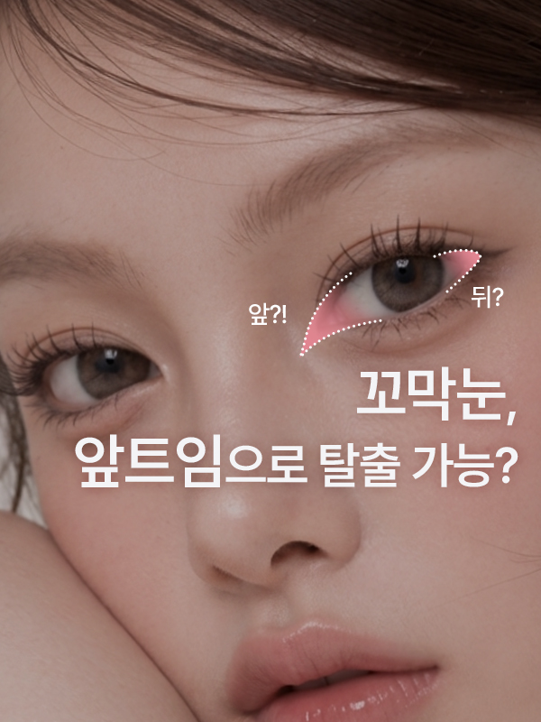 꼬막눈에 앞트임을 하면 눈이 커 보일 수 있는지 상담 이미지