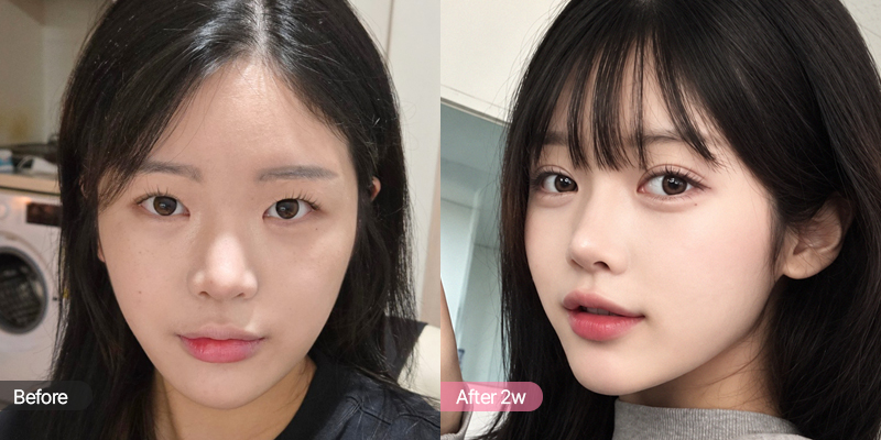 속쌍에서 화려한 인아웃 라인을 희망하는 CASE 01
