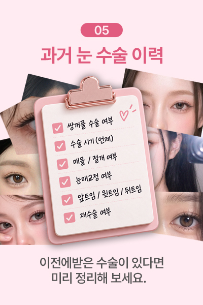 과거 눈 수술 및 시술 이력 정리