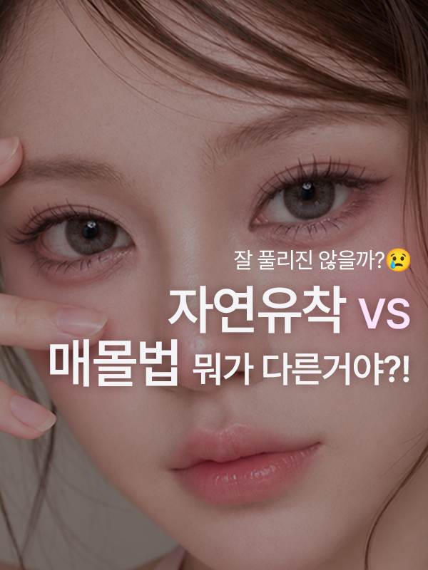 자연유착과 매몰법의 차이가 궁금한 쌍꺼풀 고민