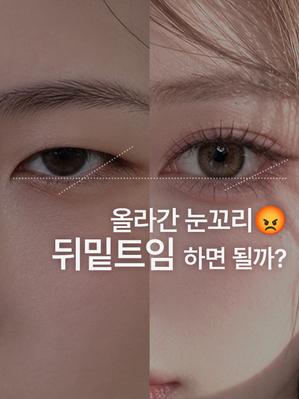 올라간 눈꼬리와 뒤밑트임 고민을 표현한 이미지