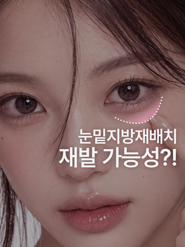 눈밑지방재배치 재발이 걱정되는 눈밑 고민 이미지