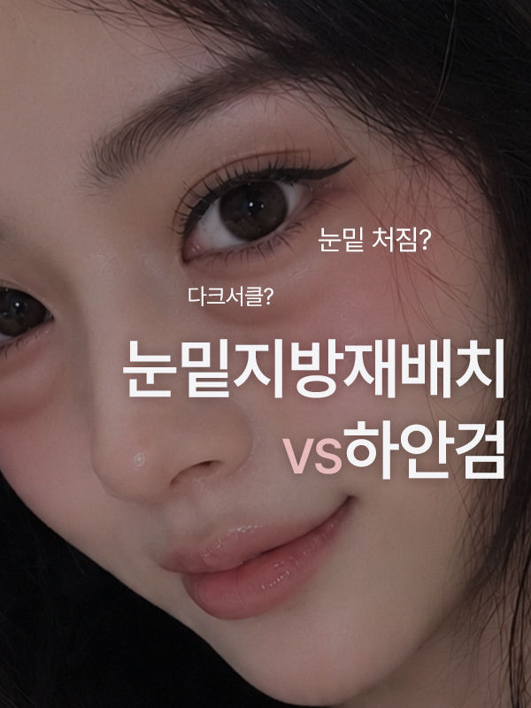 눈밑 지방과 처진 피부로 눈밑지방재배치와 하안검 사이에서 고민하는 모습