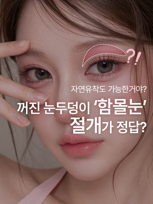눈두덩이 꺼져 보이는 함몰눈 쌍꺼풀 고민
