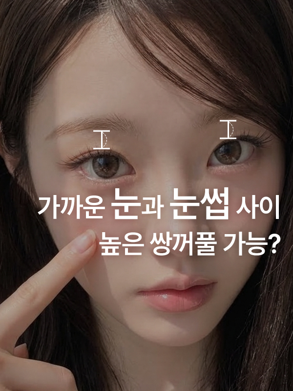 눈썹과 눈 사이가 좁아 쌍꺼풀 높이를 고민하는 눈매
