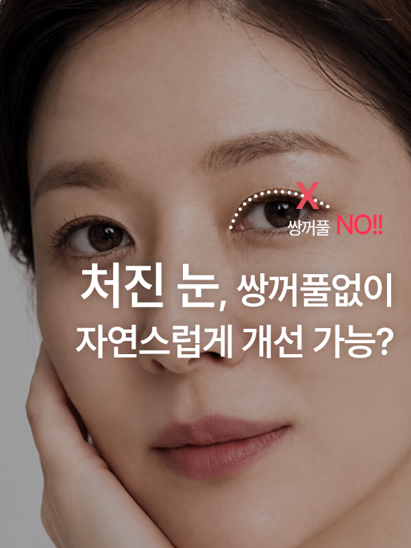 쌍꺼풀 없이 처진 눈꺼풀 개선을 고민하는 무쌍 눈매