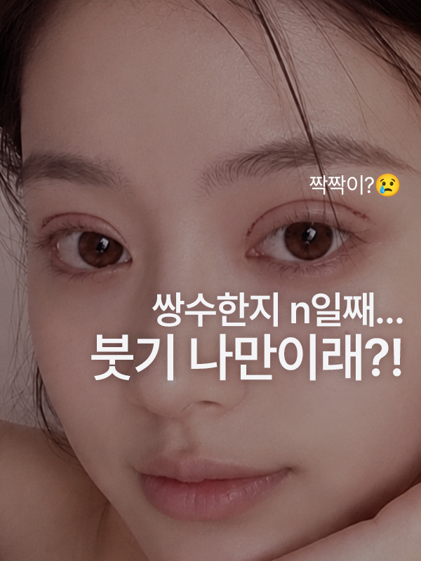 쌍꺼풀 수술 후 붓기가 빠지는 회복 과정