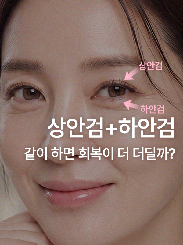 상안검 수술 회복기간과 하안검 동반 여부를 고민하는 중년 여성