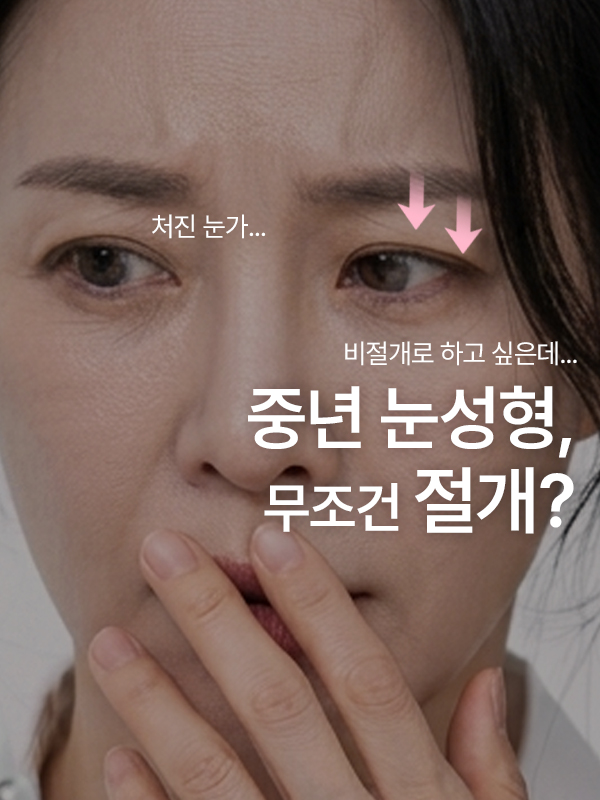 50대 중년 여성의 살짝 처진 윗눈꺼풀