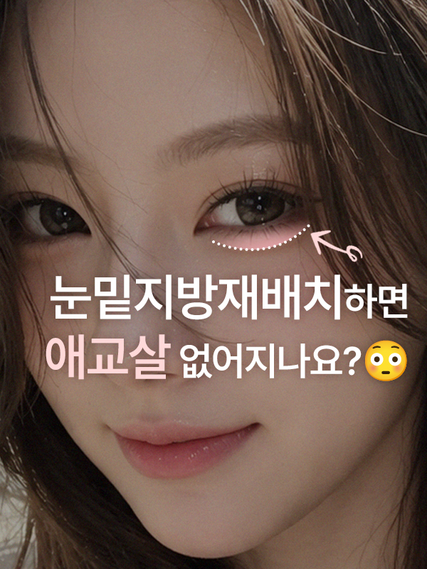 애교살과 눈밑지방이 함께 보이는 눈밑