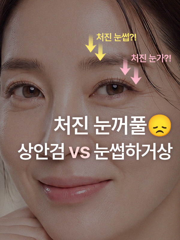 눈꺼풀이 처져 답답해 보이는 눈
